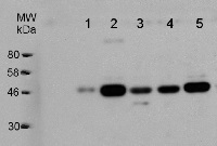 GDP-L-Galactose Phosphorylase in the group Antibodies Plant/Algal / Environmental Stress / Oxidative stress at Agrisera AB (Antibodies for research) (AS10 723)